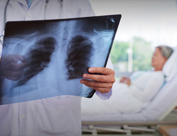 What Medicare Part B Covers