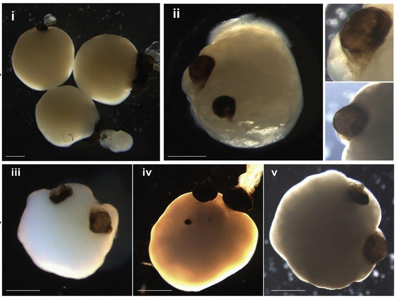What Are Brain Organoids — And Why Everyone from Startups to the Australian Military Cares