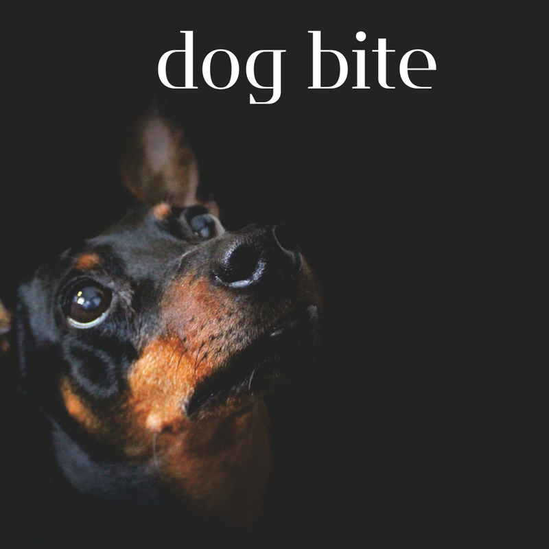 The Top Home Liability Claim Across the Country: Dog Bites